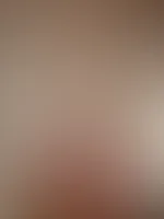Rote Netzstrümpfe