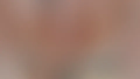 A**l