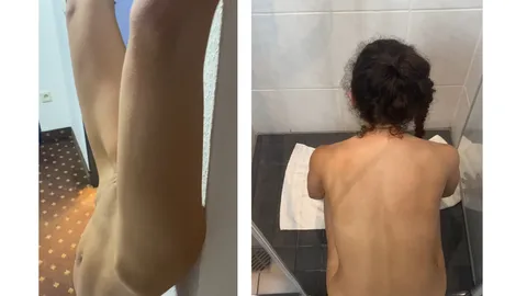 2 NS - Handstand Clips mit ungewollten Luftgeräuschen
