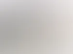 Harter NIppel ... Update zur meiner Bruststraffung!