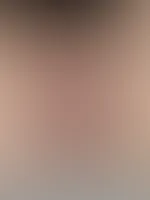 Ich und mein neuer plug