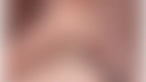 1 LIKE 1 SLAP đ©·đđ»
