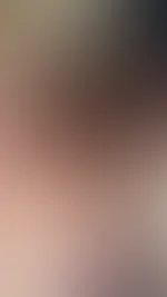 GesichtsBesarmung