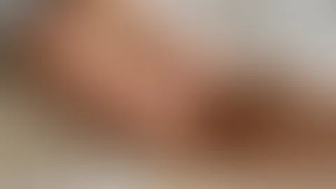 Booty verbrannt. Wer cremt mich ein?