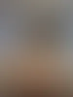 🙈