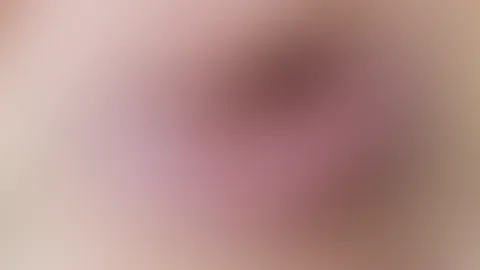 Im ABO das ganze Gesicht