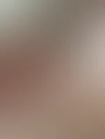Wo willst du gerne hinspritzen?