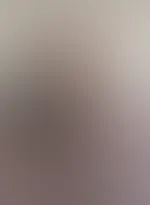 Natur oder lieber Silikon??