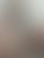 đ©° Feed-Edition đ©°