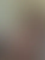 Nacktfoto