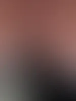 Feuchte m****i ganz nah đ€€đłđ§