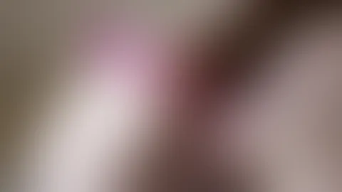 Alle Löcher gestopft