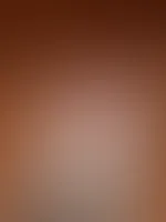 A**l