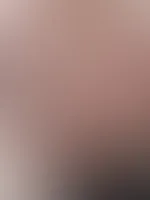 Nippel blitzer đ„”