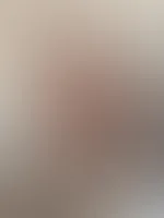 Bilderserie in roter Unterwäsche und halterlosen Nylons