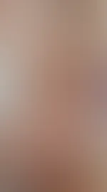 Von vorne, oder von hinten?