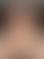 💋