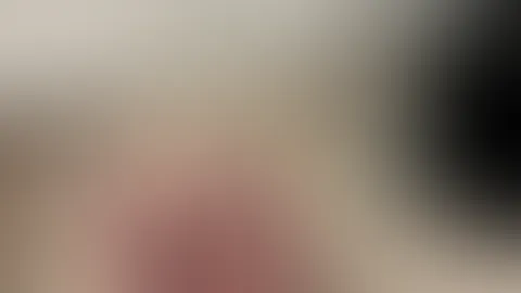 Who should scratch the back?