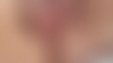 Sonnenbrand hat mich gut erwischt.đđ„