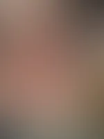 Hab am Wochenende leider einen mega Sonnenbrand bekommen ....Hilfst du mir beim eincremen ?