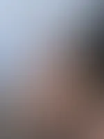 Ich wollte nur Sonne tanken⊠jetzt tanzt mein Hintern im Rampenlicht đđ