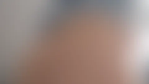 Würde ja sagen, der blaue Fleck kommt von gutem S*x - war aber nur Schlittenfahren ❄️🛷😅
