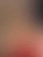 Frühstück mit Latex