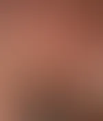 :)