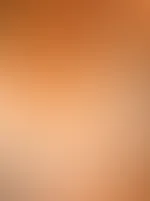 Die Wenigsten Wissen es! Ich habe mich letzte Woche einer Brustverkleinerung unterzogen. Seit meinem 16. Lebensjahr hatte ich ein F-Körbchen und das hat mir, sowohl psychisch als auch physisch in vers