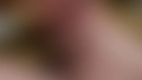 Sextape nach dem Live